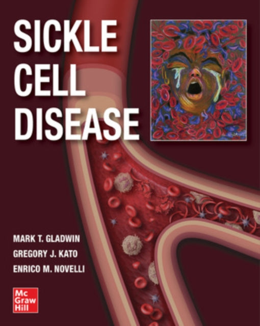 Book cover of: Sickle Cell Disease. By: Mark T. Gladwin