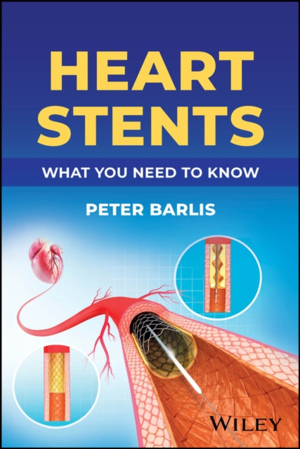 Book cover of: Heart Stents. By: Barlis