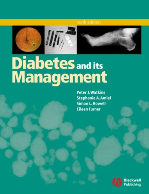 Book cover of: Diabetes and Its Management. By: Peter J. Watkins