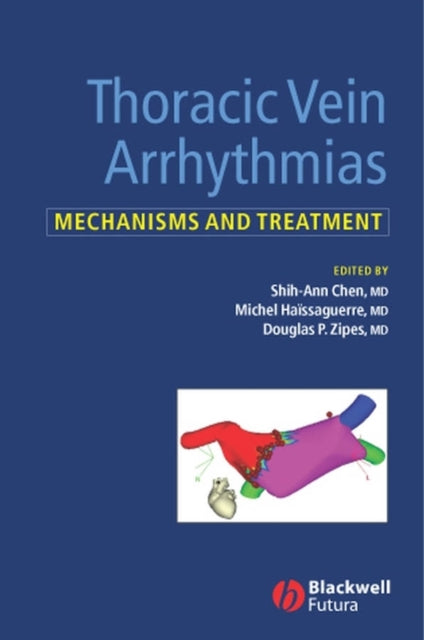 Book cover of: Thoracic Vein Arrhythmias. By: Michel Haissaguerre