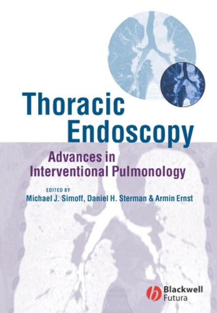 Book cover of: Thoracic Endoscopy. By: Daniel Sterman
