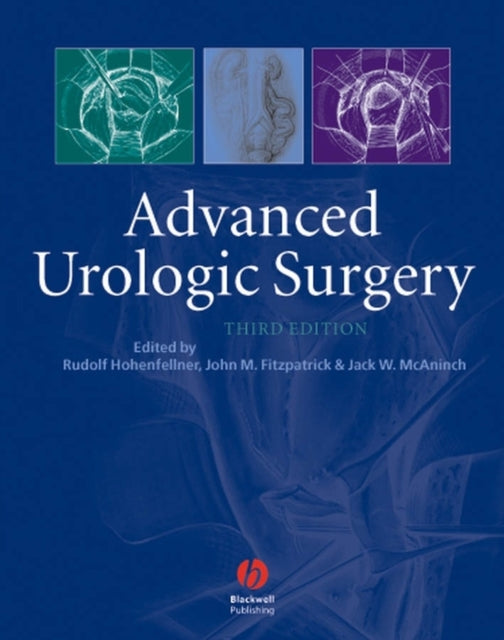 Book cover of: Advanced Urologic Surgery