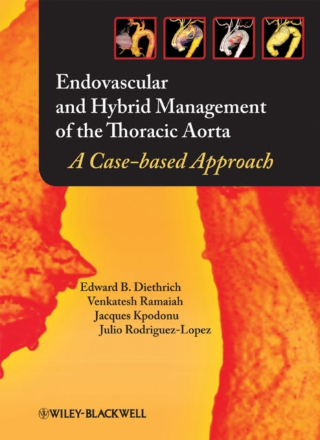 Book cover of: Endovascular and Hybrid Management of the Thoracic Aorta