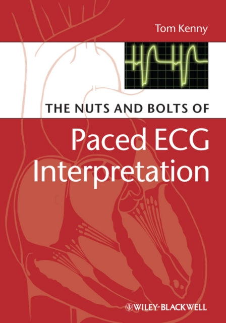 Book cover of: Nuts and bolts of Paced ECG Interpretation. By: Kenny, Tom