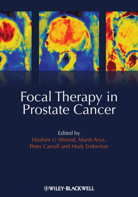 Book cover of: Focal Therapy in Prostate Cancer