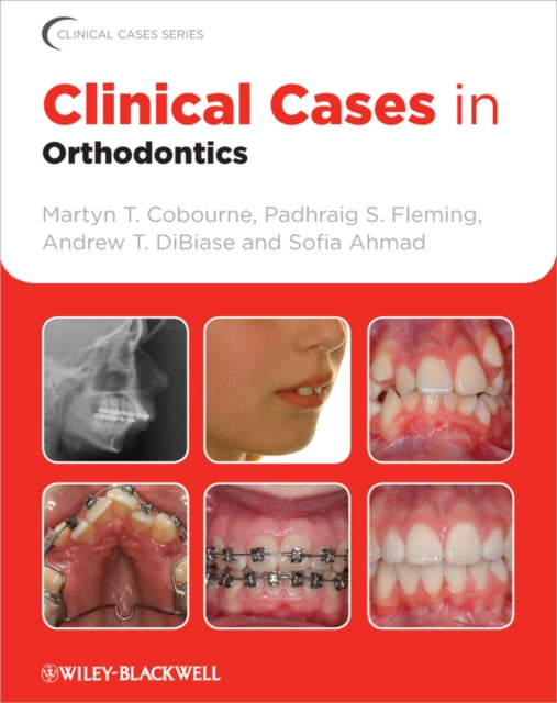 Book cover of: Clinical Cases in Orthodontics. By: Martyn T. Cobourne
