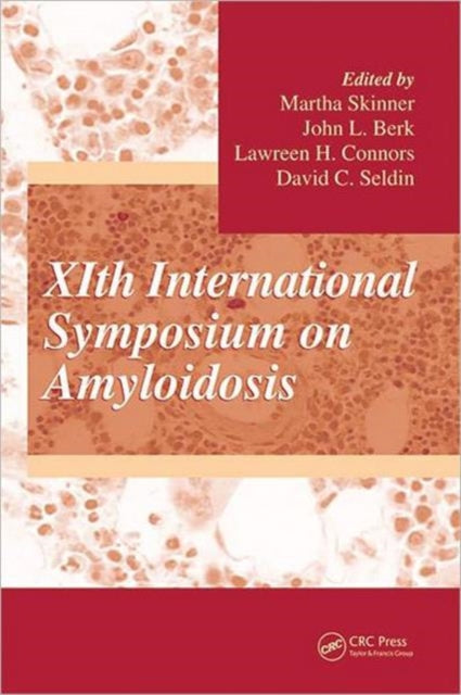 Book cover of: XIth International Symposium on Amyloidosis. By: International Symposium on Amyloidosis (11th 2006 Woods Hole, Mass.)