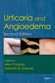 Book cover of: Urticaria and Angioedema