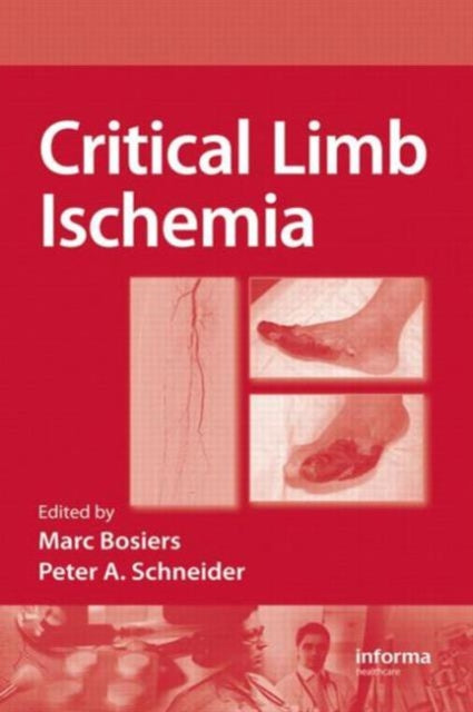Book cover of: Critical Limb Ischemia