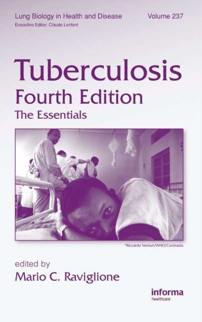 Book cover of: Tuberculosis