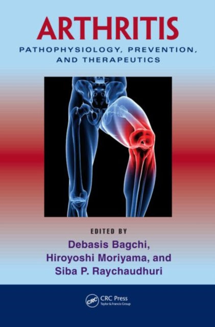 Book cover of: Arthritis. By: Debasis Bagchi