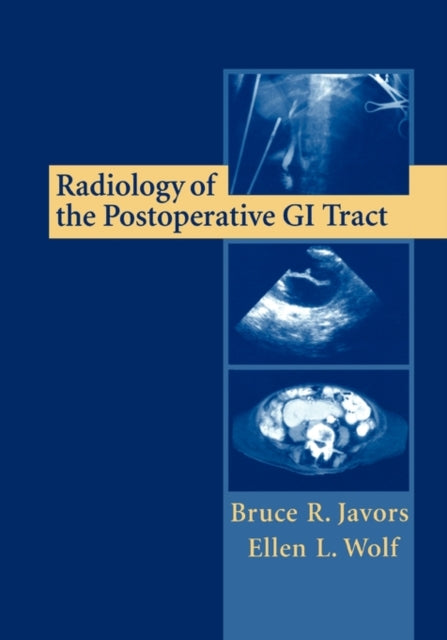 Book cover of: Radiology of the Postoperative GI Tract. By: Bruce R. Javors