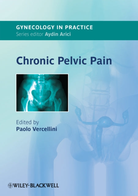 Book cover of: Chronic Pelvic Pain. By: Paolo Vercellini