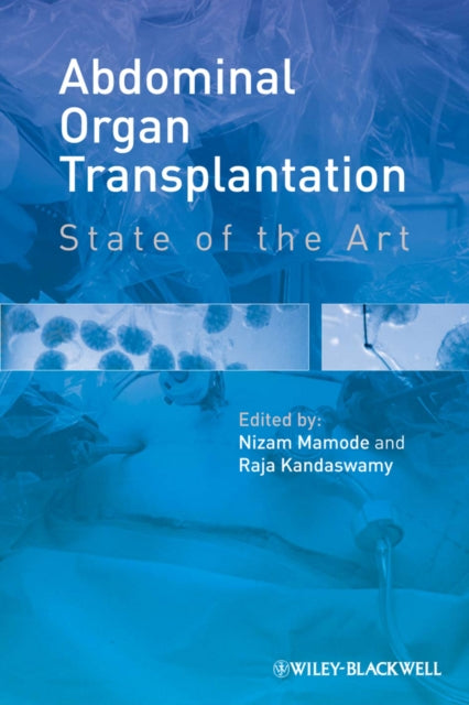 Book cover of: Abdominal Organ Transplantation. By: Nizam Mamode