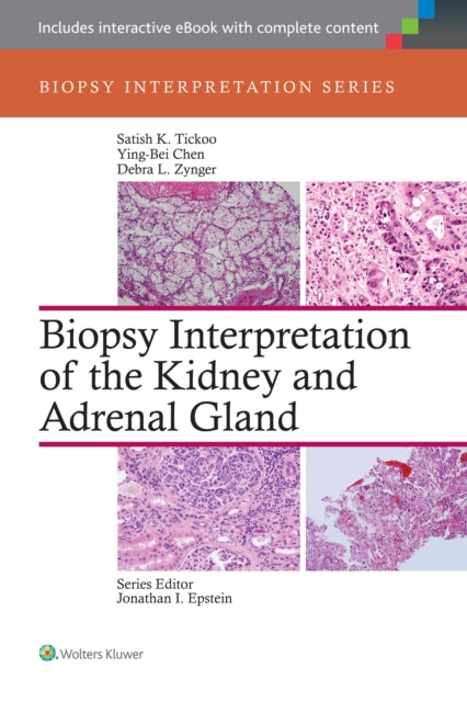 Book cover of: Biopsy Interpretation of the Kidney & Adrenal Gland. By: Satish Tickoo