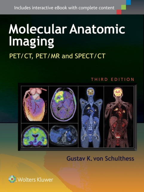 Book cover of: Molecular Anatomic Imaging. By: Gustav K. von Schulthess
