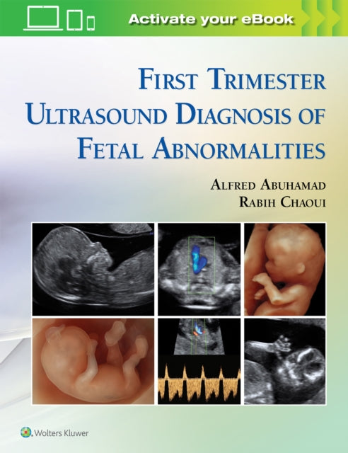 Book cover of: First Trimester Ultrasound Diagnosis of Fetal Abnormalities. By: Alfred Z. Abuhamad MD
