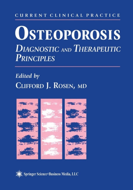 Book cover of: Osteoporosis. By: Clifford J. Rosen