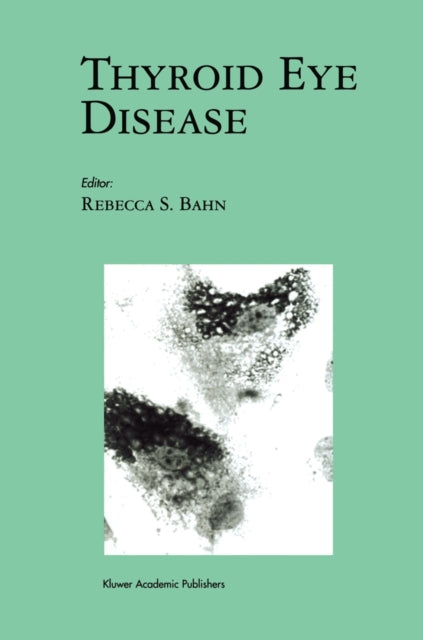 Book cover of: Thyroid Eye Disease. By: Rebecca S. Bahn