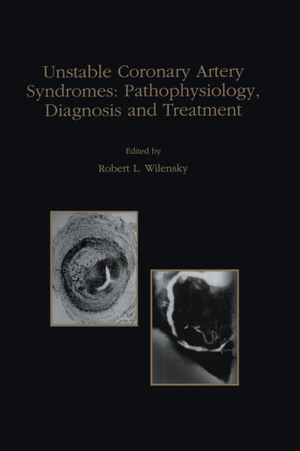 Book cover of: Unstable Coronary Artery Syndromes Pathophysiology, Diagnosis and Treatment. By: Robert L. Wilensky