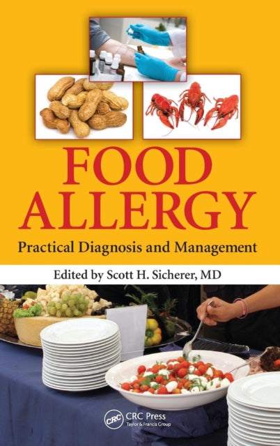 Book cover of: Food Allergy