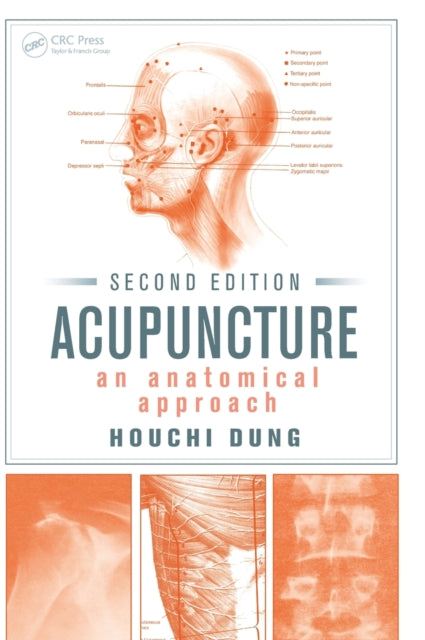 Book cover of: Acupuncture. By: Houchi Dung