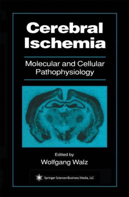 Book cover of: Cerebral Ischemia. By: Wolfgang Walz