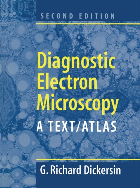 Book cover of: Diagnostic Electron Microscopy. By: Richard G. Dickersin