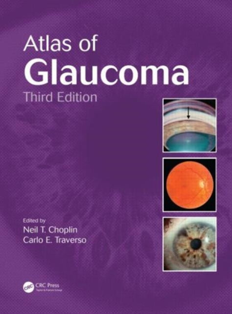 Book cover of: Atlas of Glaucoma