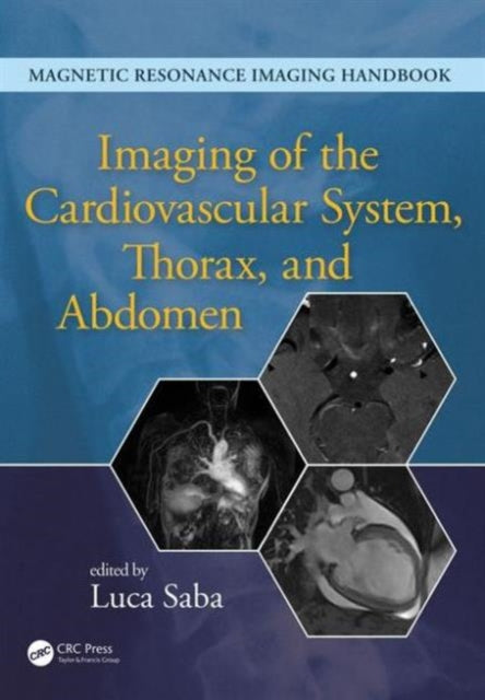 Book cover of: Imaging of the Cardiovascular System, Thorax, and Abdomen. By: Luca Saba
