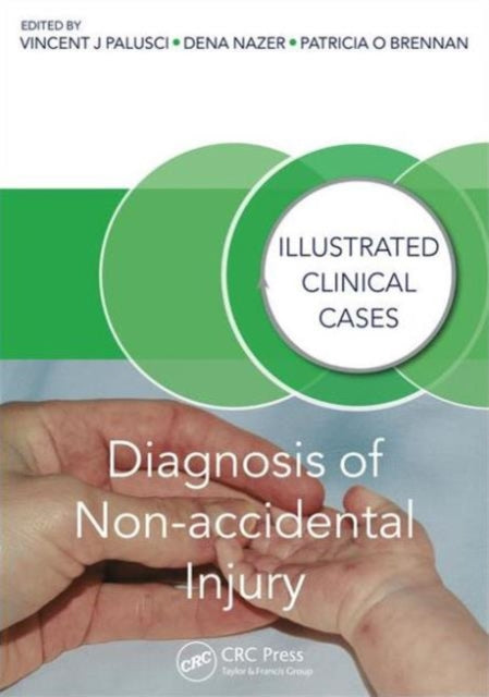 Book cover of: Diagnosis of Non-accidental Injury. By: Vincent J. Palusci