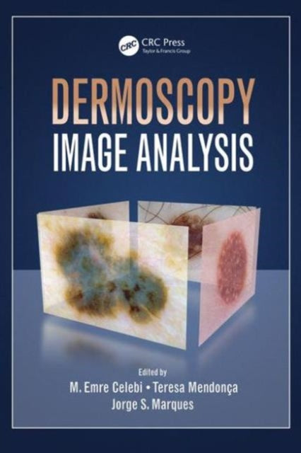 Book cover of: Dermoscopy Image Analysis. By: M. Emre Celebi