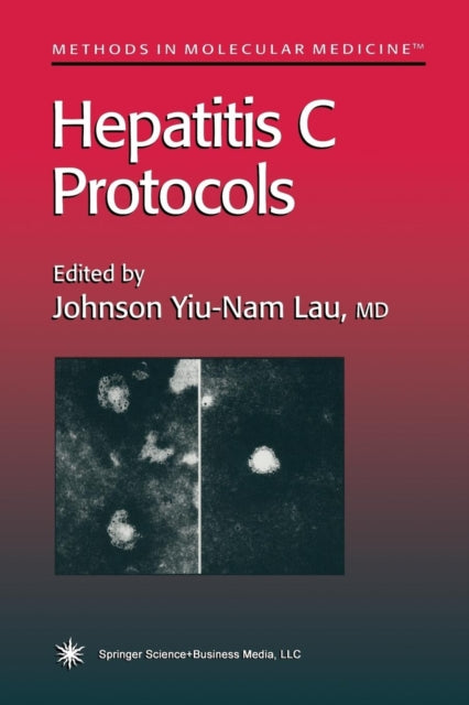 Book cover of: Hepatitis C Protocols. By: Johnson Y. N. Lau