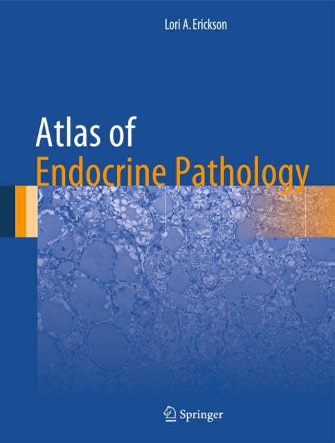 Book cover of: Atlas of Endocrine Pathology. By: Lori A. Erickson