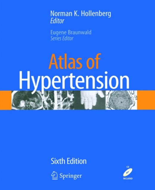 Book cover of: Atlas of Hypertension