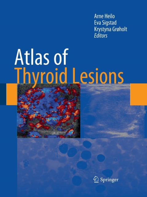 Book cover of: Atlas of Thyroid Lesions. By: Arne Heilo