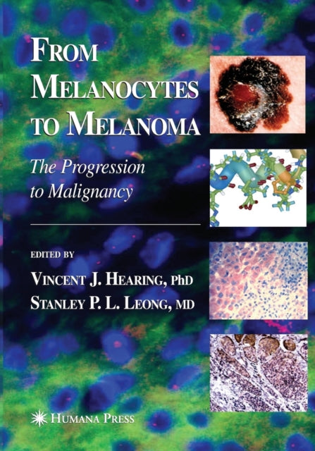 Book cover of: From Melanocytes to Melanoma. By: Vincent J. Hearing