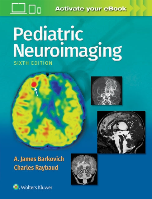 Book cover of: Pediatric Neuroimaging. By: A. James Barkovich MD