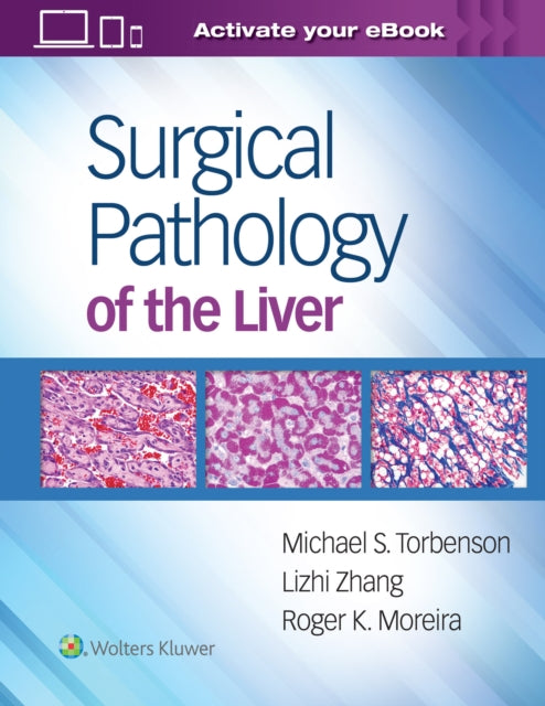 Book cover of: Surgical Pathology of the Liver. By: Michael Torbenson MD