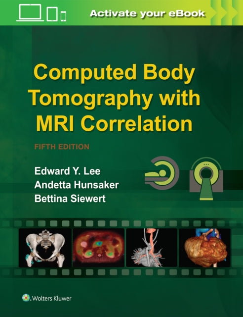 Book cover of: Computed Body Tomography with MRI Correlation. By: Edward Y. Lee MD  MPH