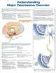 Book cover of: Understanding Major Depressive Disorder