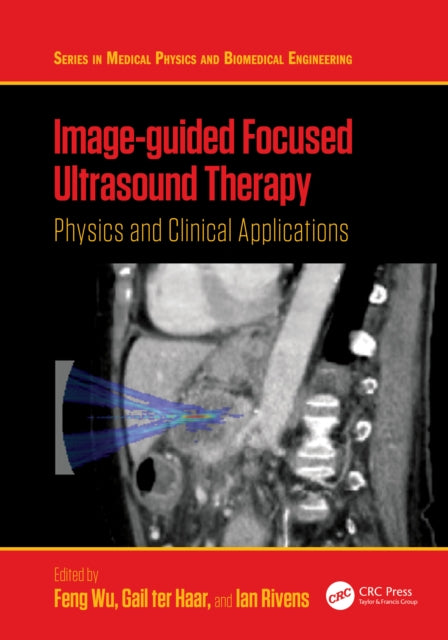 Book cover of: Image-guided Focused Ultrasound Therapy. By: Feng Wu