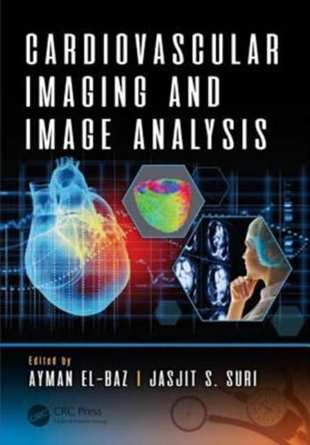 Book cover of: Cardiovascular Imaging and Image Analysis. By: Ayman El-Baz