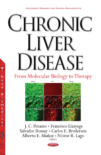Book cover of: Chronic Liver Disease. By: J. C. Perazzo