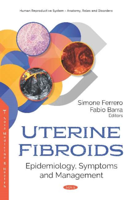 Book cover of: Uterine Fibroids. By: Simone Ferrero