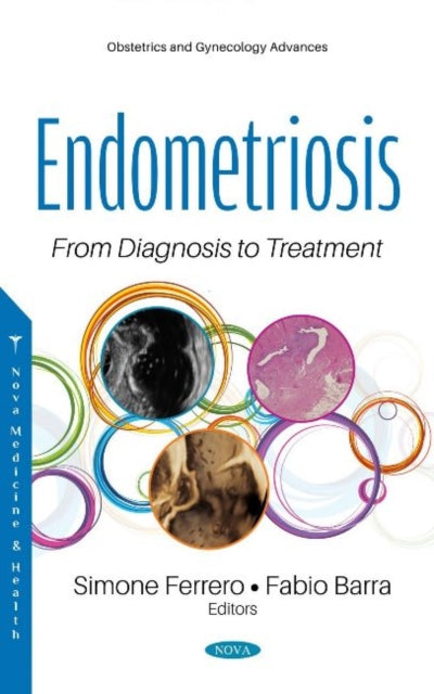 Book cover of: Endometriosis. By: Simone Ferrero