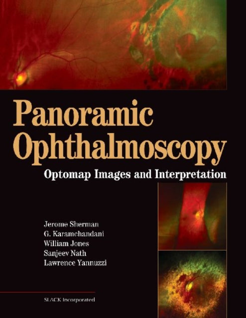 Book cover of: Panoramic Ophthalmoscopy. By: Jerry Sherman