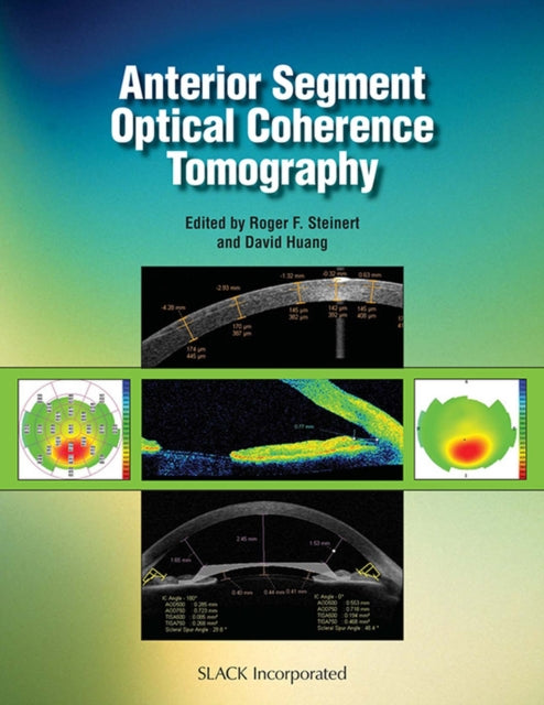 Book cover of: Anterior Segment Optical Coherence Tomography. By: Roger Steinert