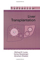 Book cover of: Liver Transplantation. By: Michael R. Lucey