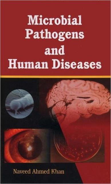 Book cover of: Microbial Pathogens and Human Diseases. By: Naveed Ahmed Khan